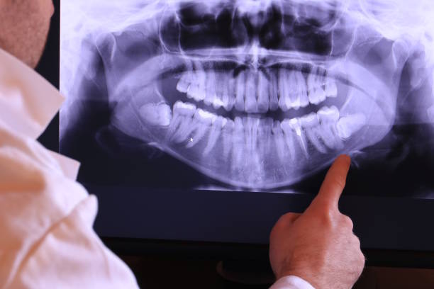 Best Mobile Emergency Dentist in Hobart, IN
